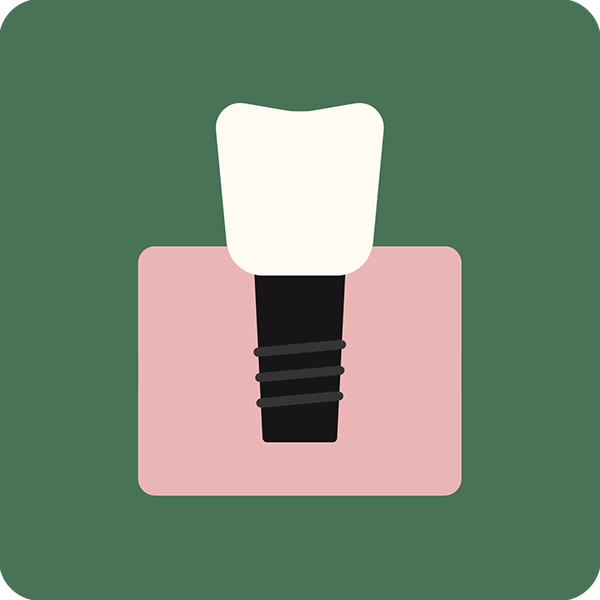 Implantaten