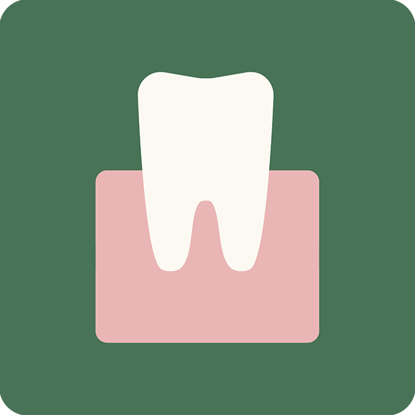 Mucogingivale chirurgie